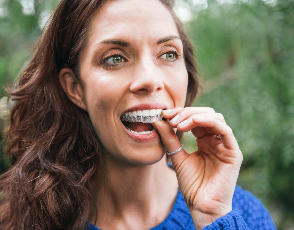 neviditeľný strojček na zuby invisalign