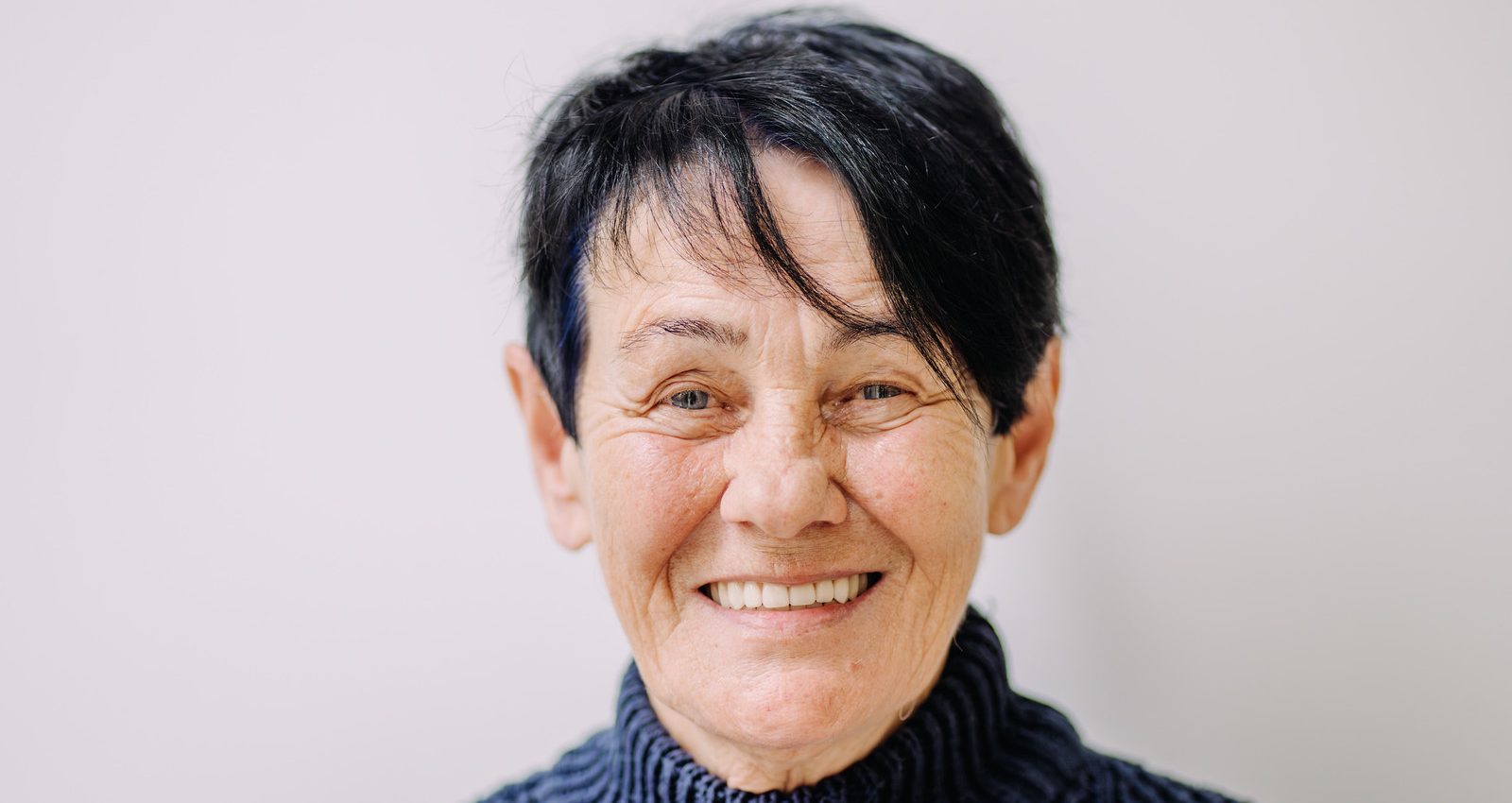 pani Katarína nová snímateľná protéza