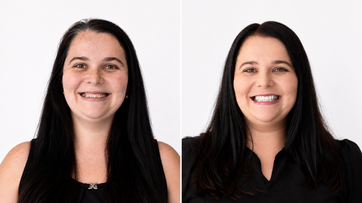 Dagmar Schill Dental Clinic premena pred a po